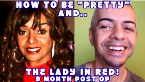 Read more about the article 9 month Post Op Dr. Andrew Jacono Facelift Lower Blepharoplasty Transgender