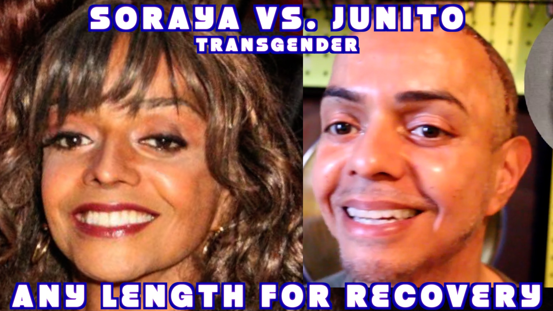 Read more about the article Recovery Gender Dysphoria Brow Lift Fat Transfer to Cheeks MTF Latinx