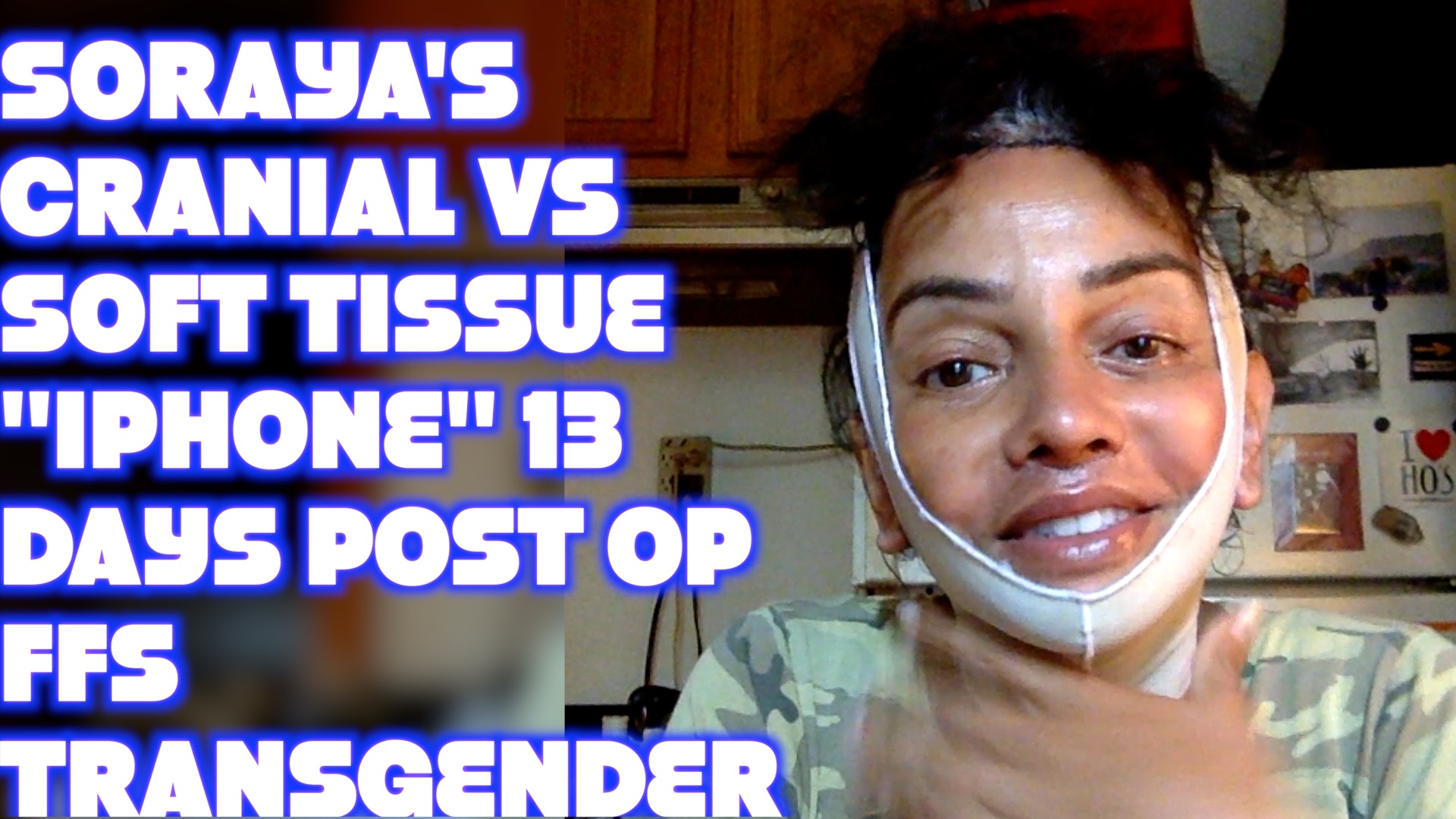 Read more about the article Cranial VS. Soft Tissue iPhone 13 Days Post Op FFS Transgender